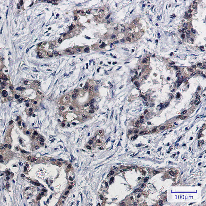 Rabbit Monoclonal Antibody to PSMB10