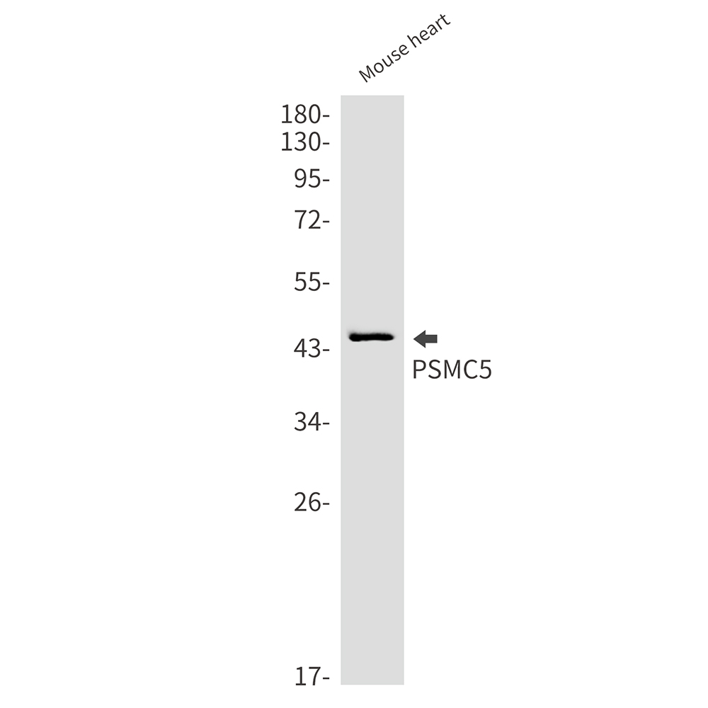 PSMC5