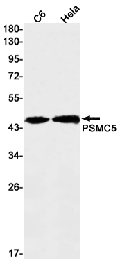 Rabbit Monoclonal Antibody to PSMC5