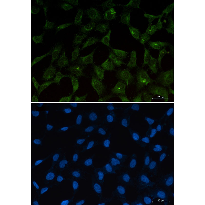 Rabbit Monoclonal Antibody to PUMA