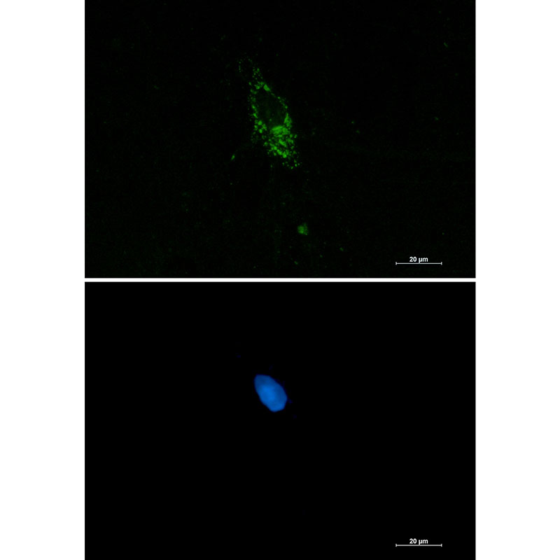 Rabbit Monoclonal Antibody to PUM1