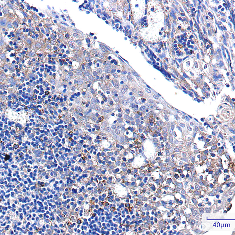 Rabbit Monoclonal Antibody to PUM1
