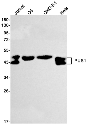 PUS1