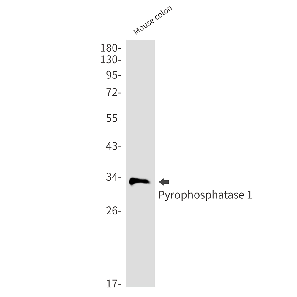Pyrophosphatase 1
