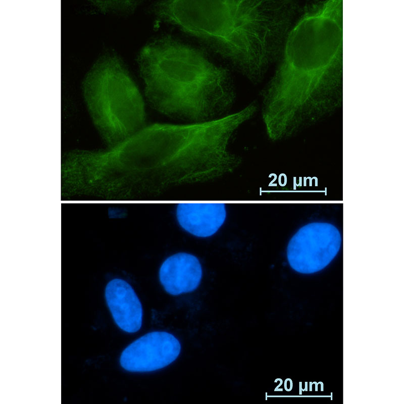 Rabbit Monoclonal Antibody to Rab10