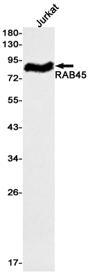 Rabbit Monoclonal Antibody to Rab45