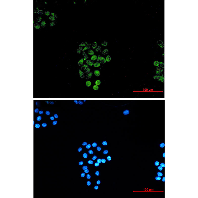 Rabbit Monoclonal Antibody to Rab45