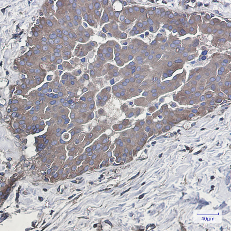 Rabbit Monoclonal Antibody to Rab5