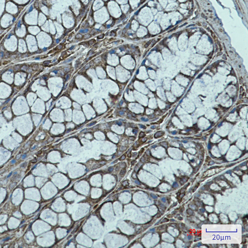 Rabbit Monoclonal Antibody to Rab7