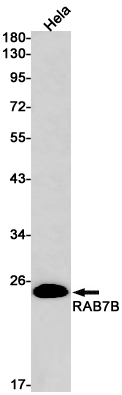 Rab7B