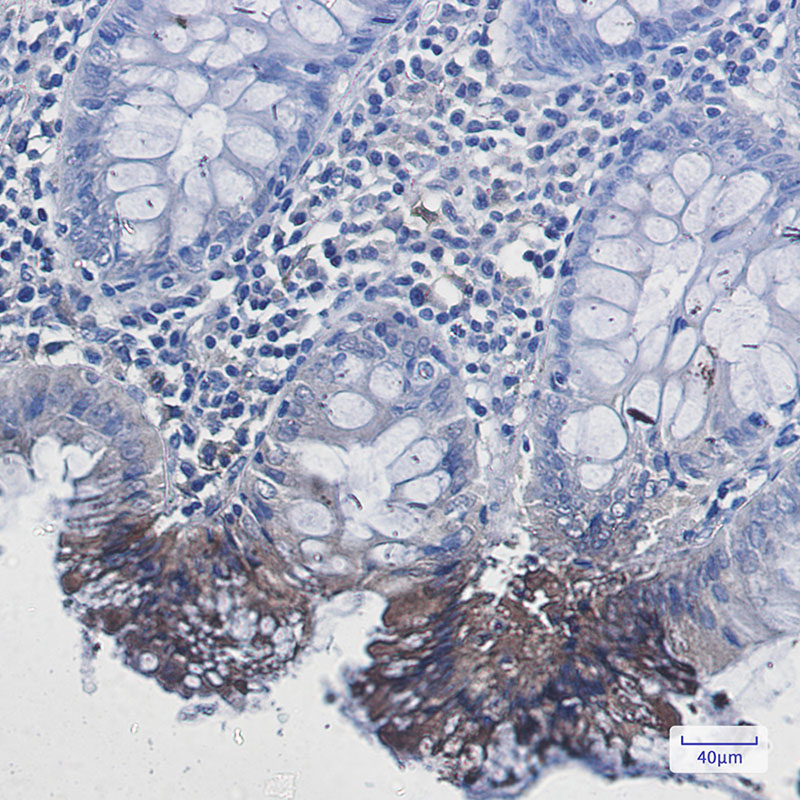 Rabbit Monoclonal Antibody to Rab9