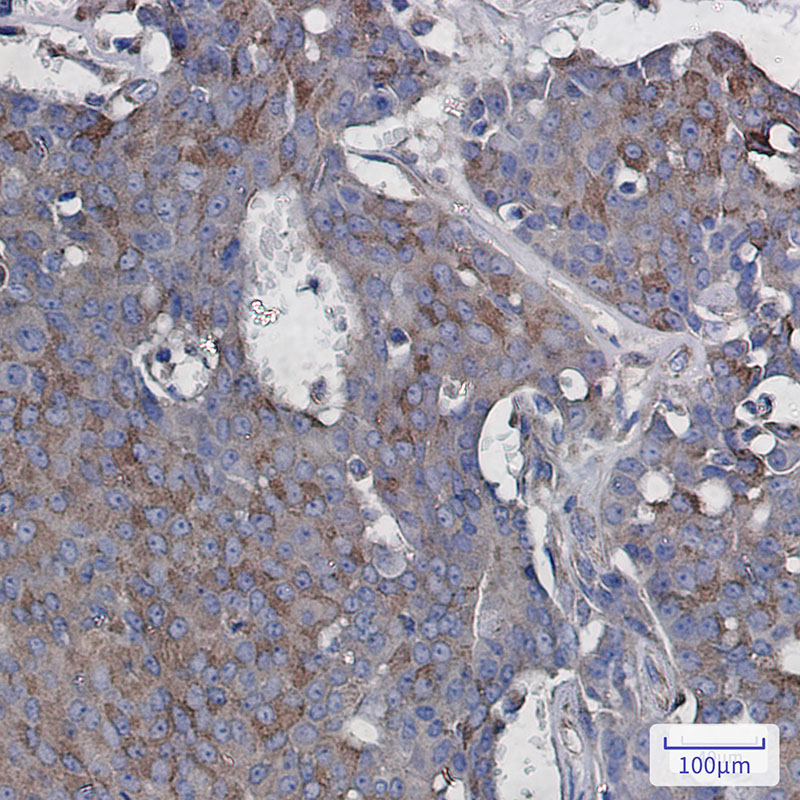 Rabbit Monoclonal Antibody to Rac3