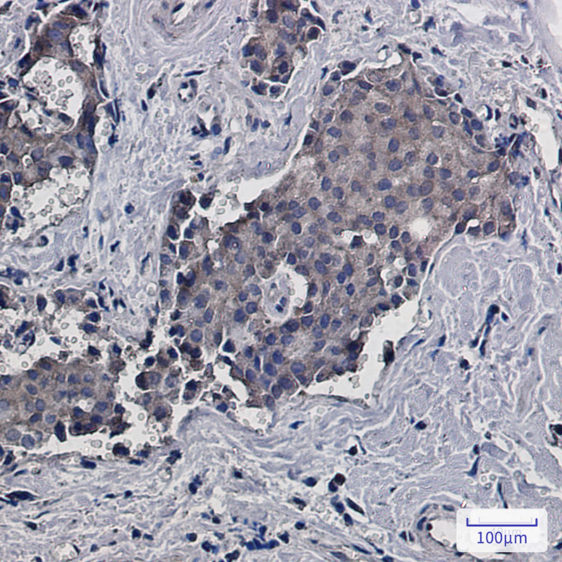 Rabbit Monoclonal Antibody to RACK1
