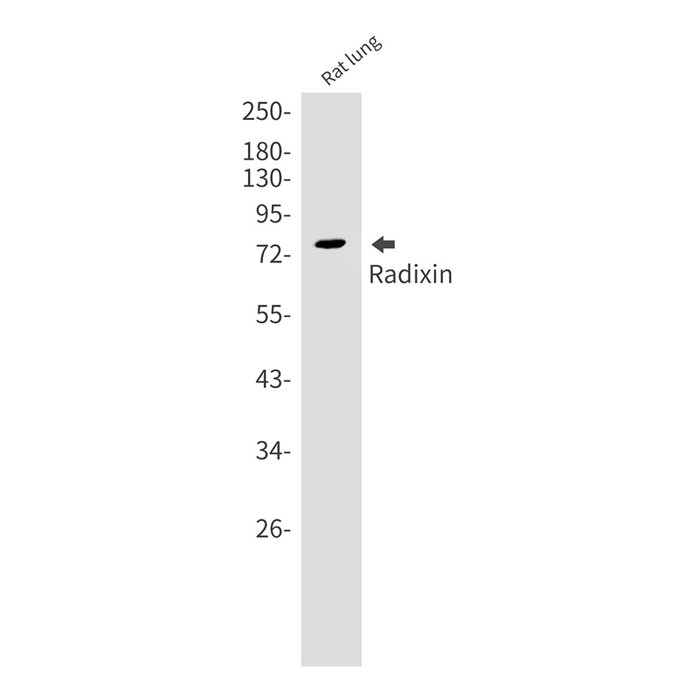 Radixin