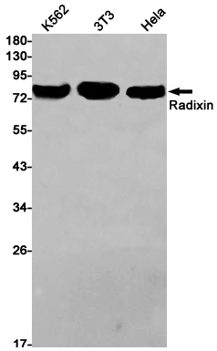Rabbit Monoclonal Antibody to Radixin