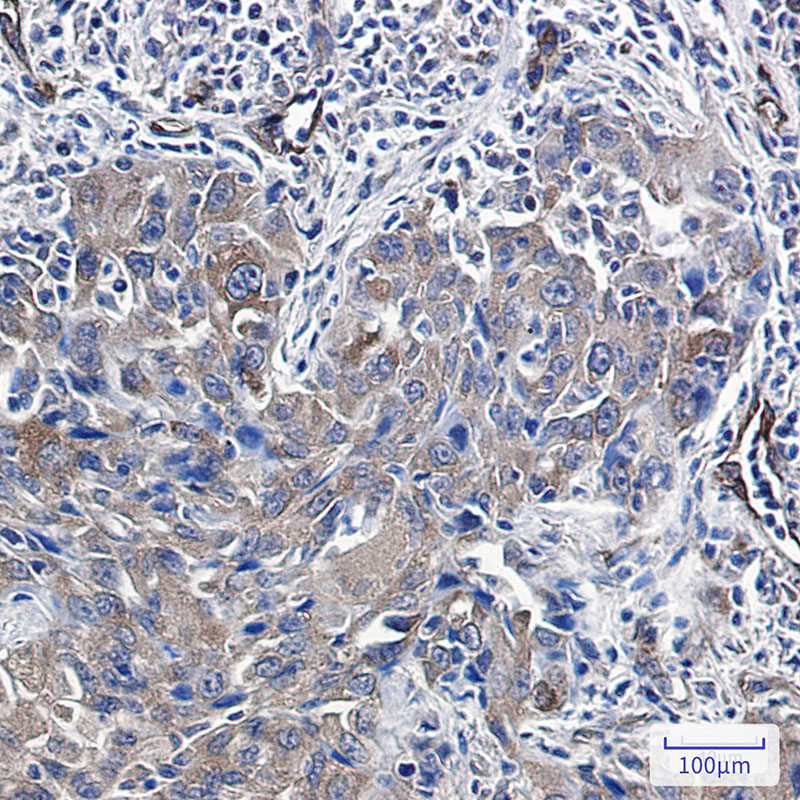 Rabbit Monoclonal Antibody to Radixin