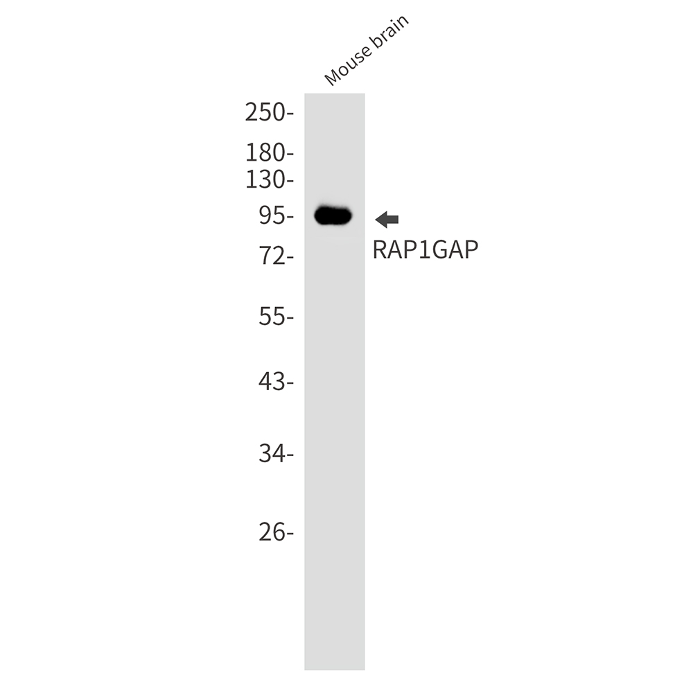 RAP1GAP