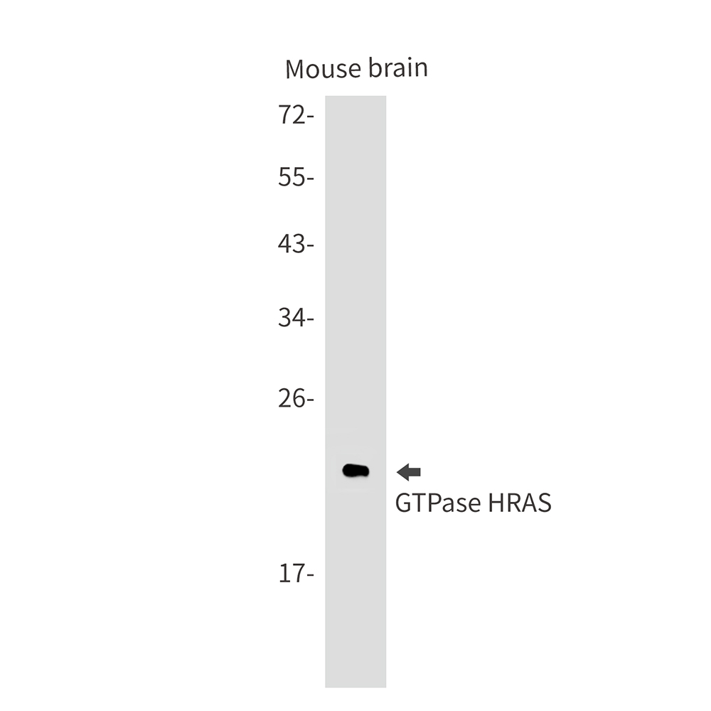GTPase HRAS