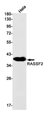 RASSF2