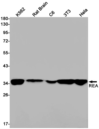 REA