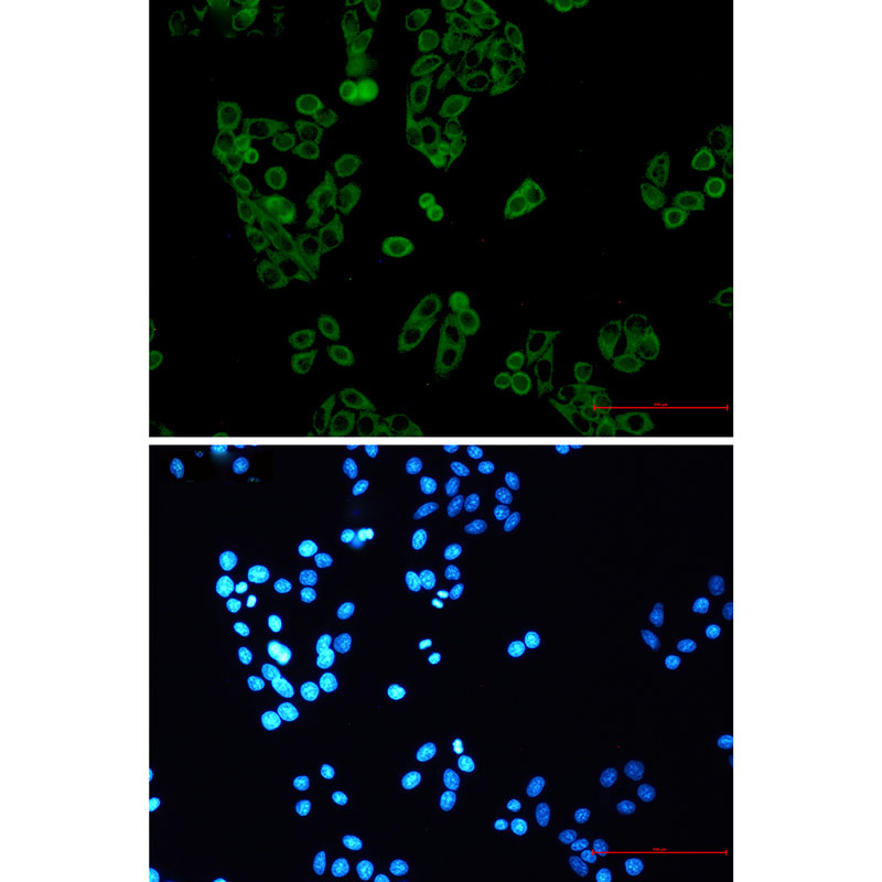 Rabbit Monoclonal Antibody to RENT1