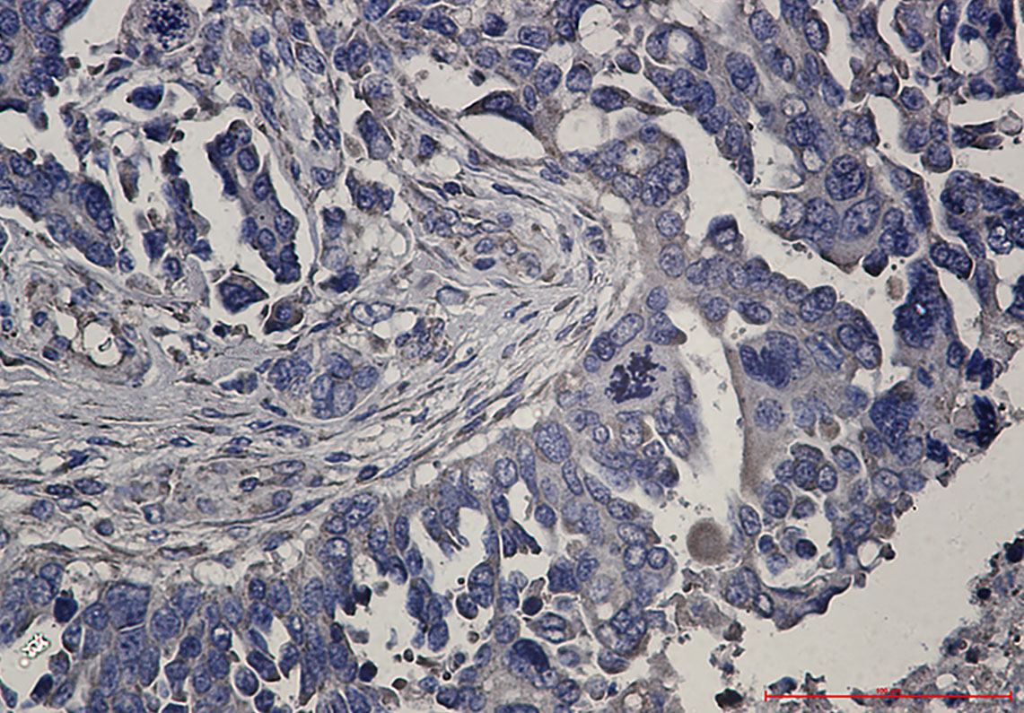 Rabbit Monoclonal Antibody to RENT1