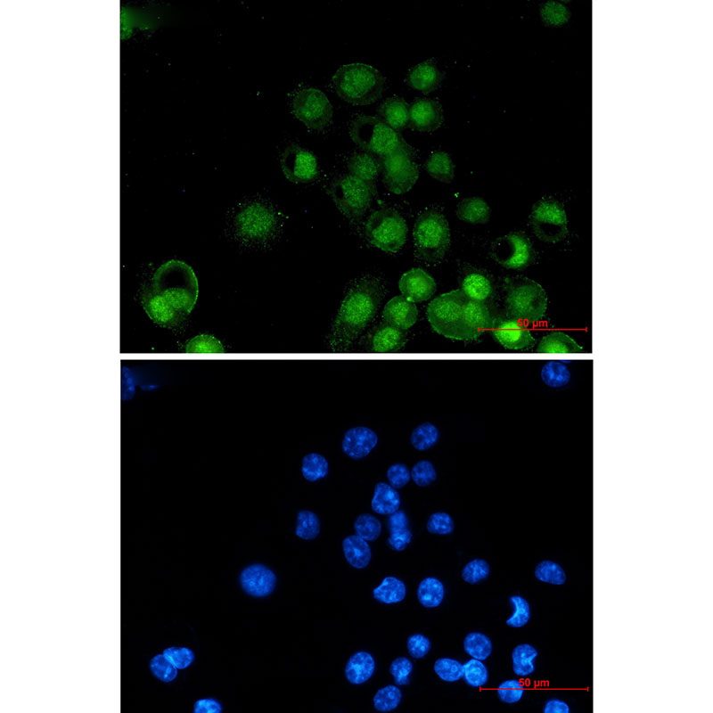 Rabbit Monoclonal Antibody to Retinoid X Receptor alpha