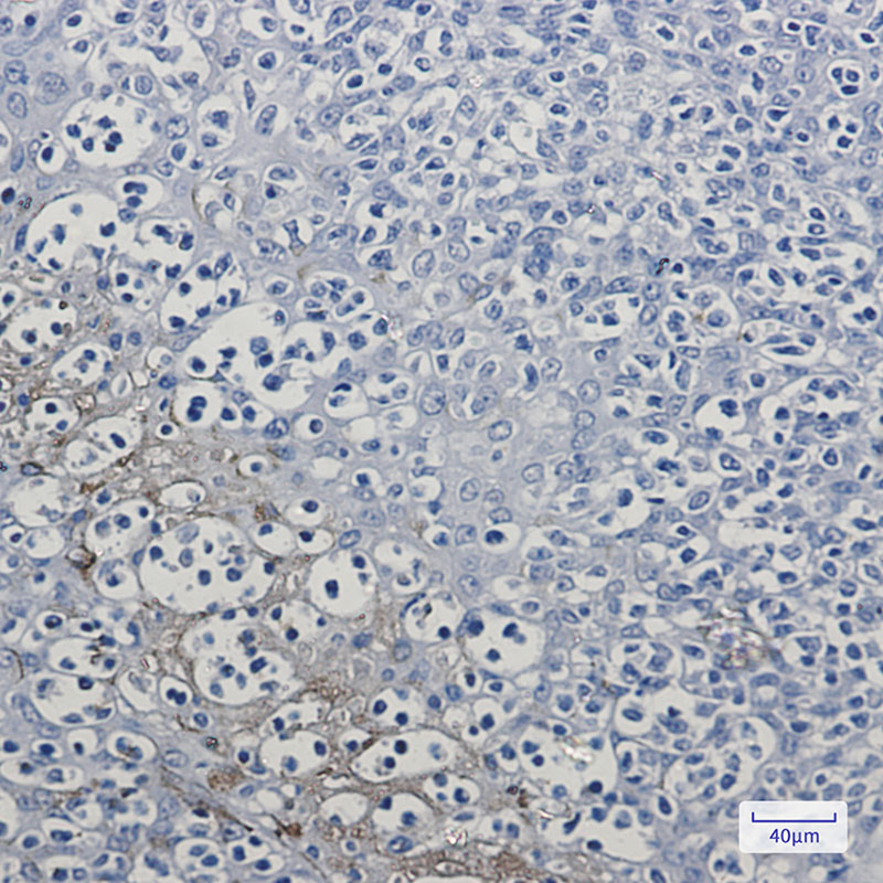 Rabbit Monoclonal Antibody to RKIP
