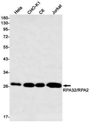 Rabbit Monoclonal Antibody to RPA32