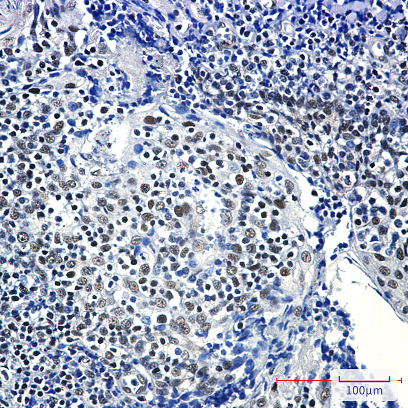 Rabbit Monoclonal Antibody to RPA32