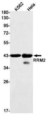 RRM2
