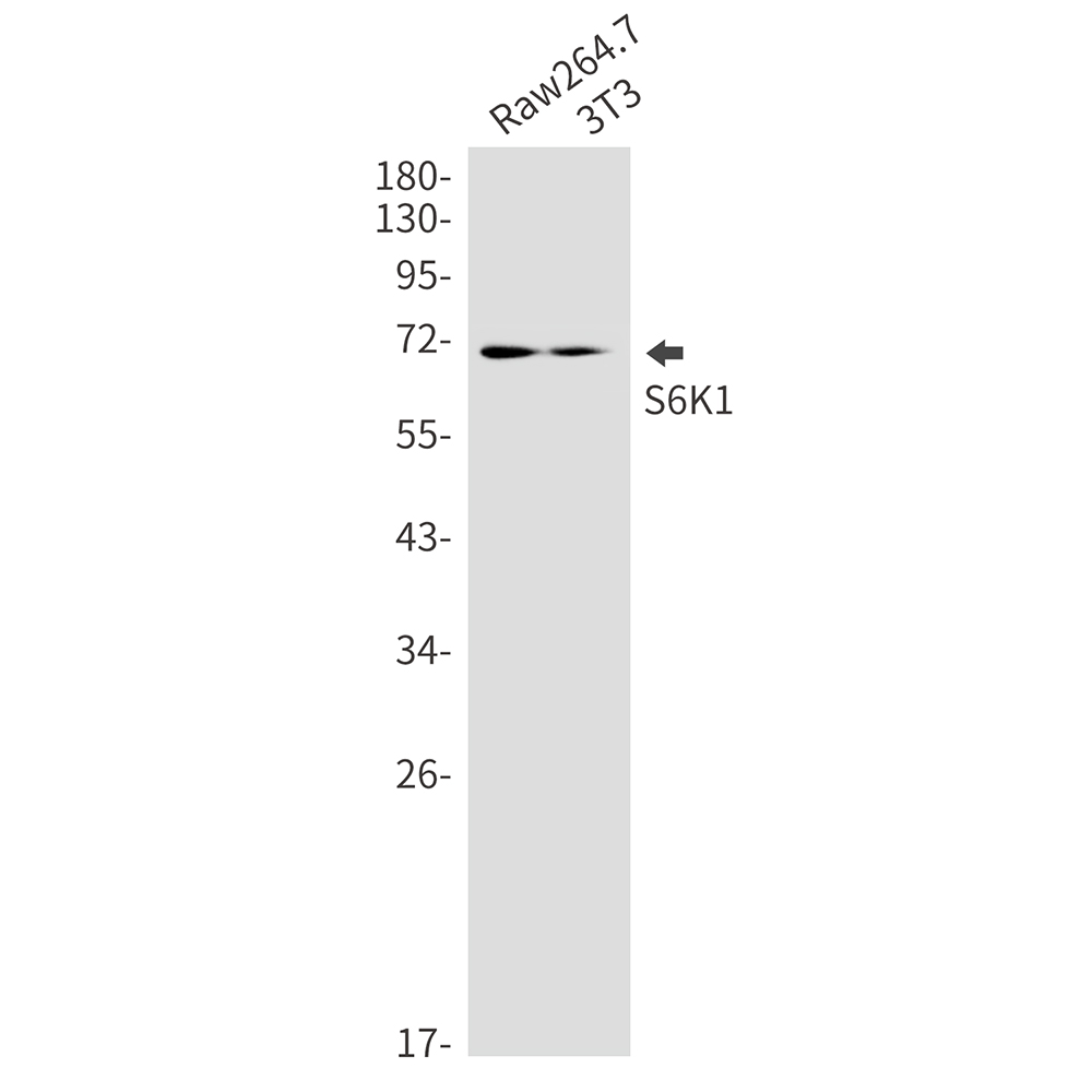 S6K1