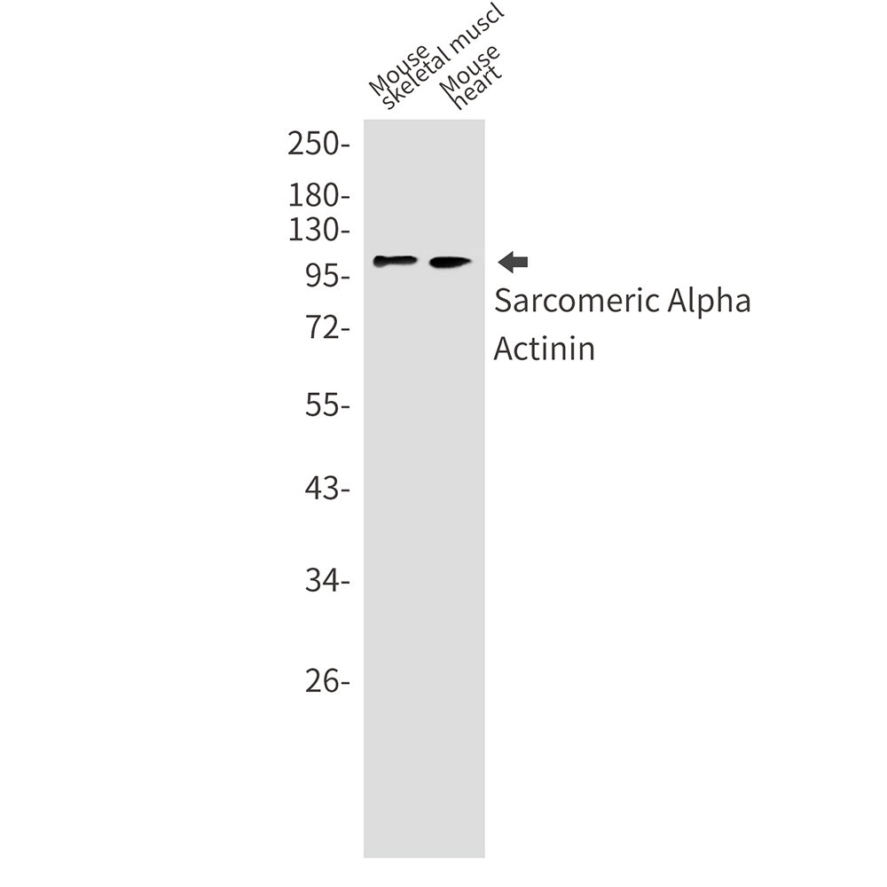 Sarcomeric alpha Actinin