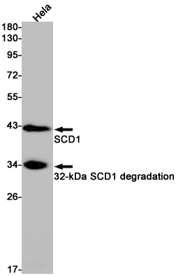SCD1