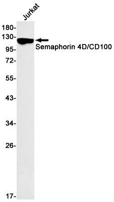 Semaphorin 4D