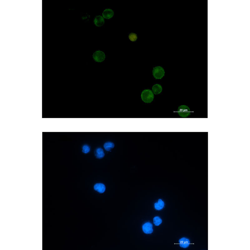 Rabbit Monoclonal Antibody to Semaphorin 4D