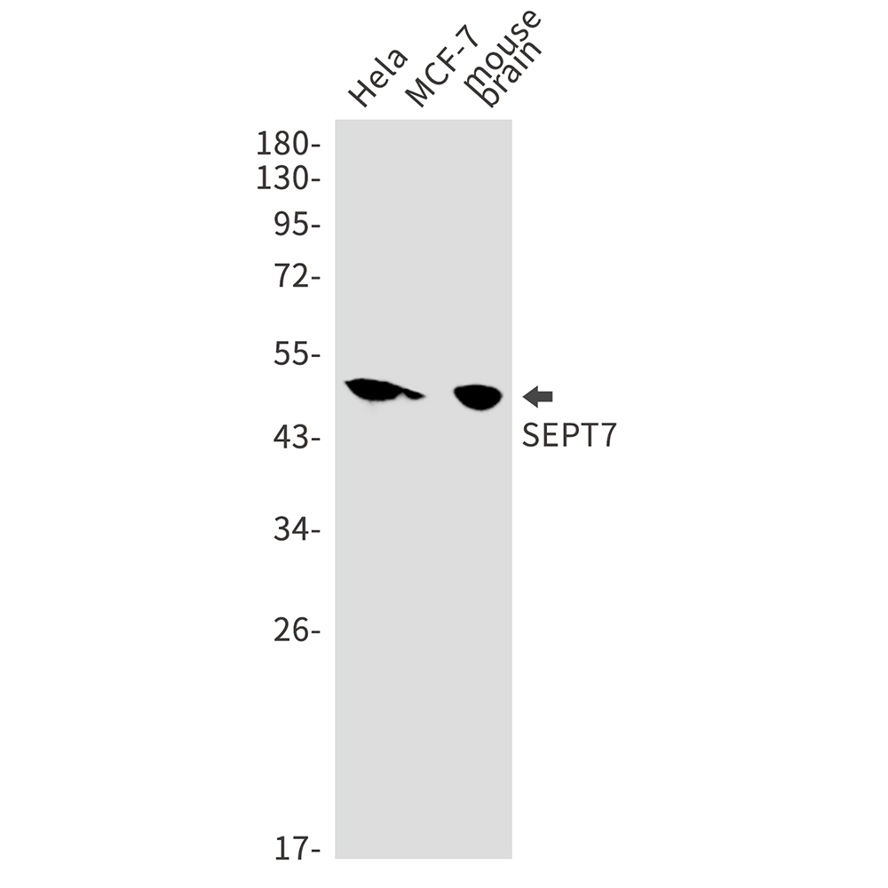 Rabbit Monoclonal Antibody to Septin 7
