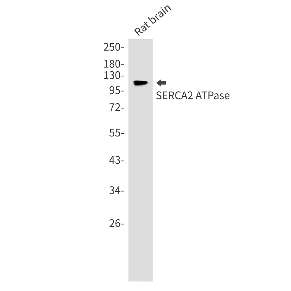 SERCA2 ATPase