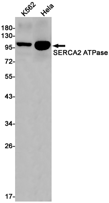 Rabbit Monoclonal Antibody to SERCA2 ATPase