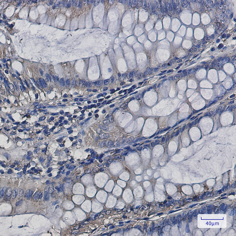 Rabbit Monoclonal Antibody to SERCA2 ATPase