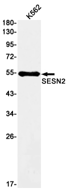 SESN2