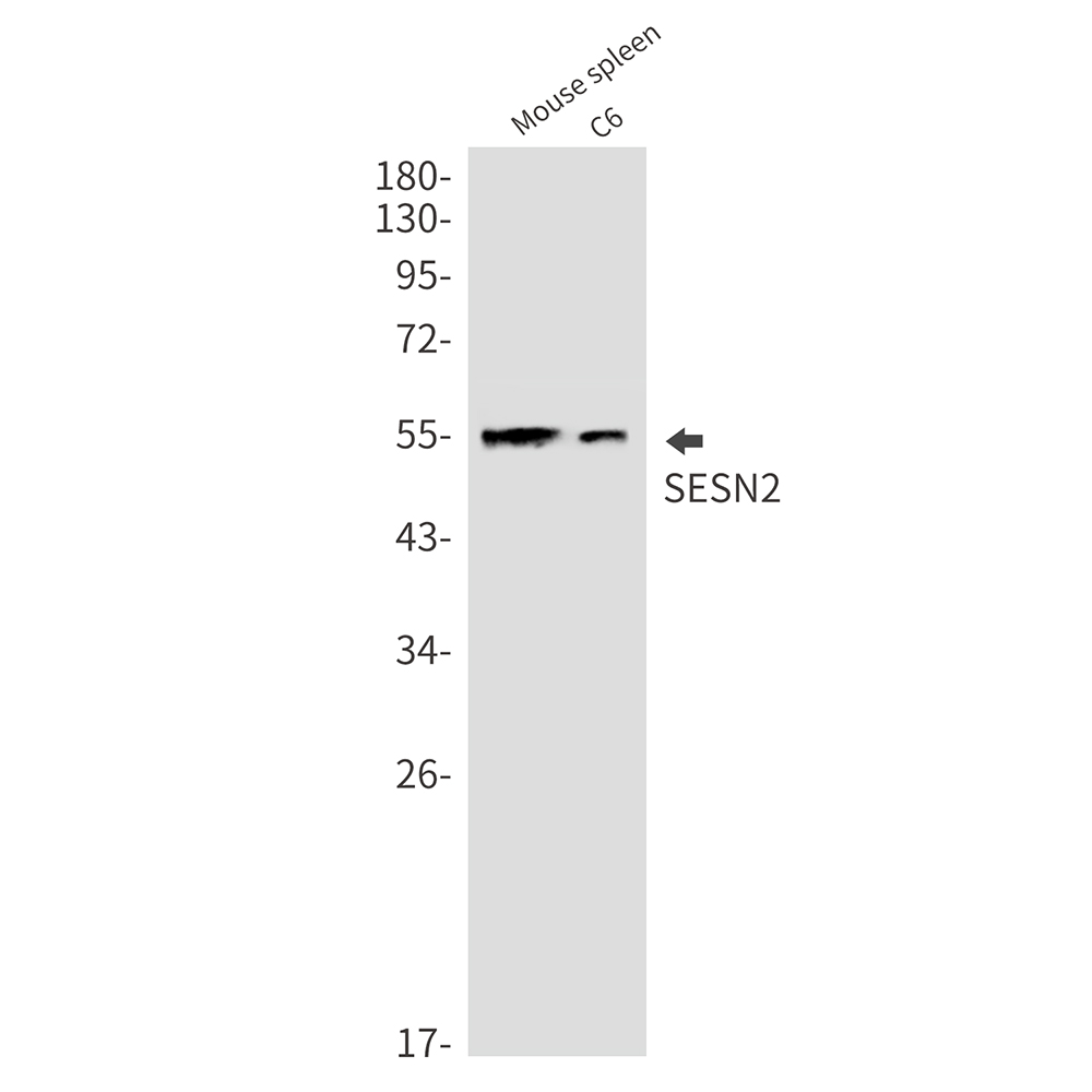 Rabbit Monoclonal Antibody to SESN2