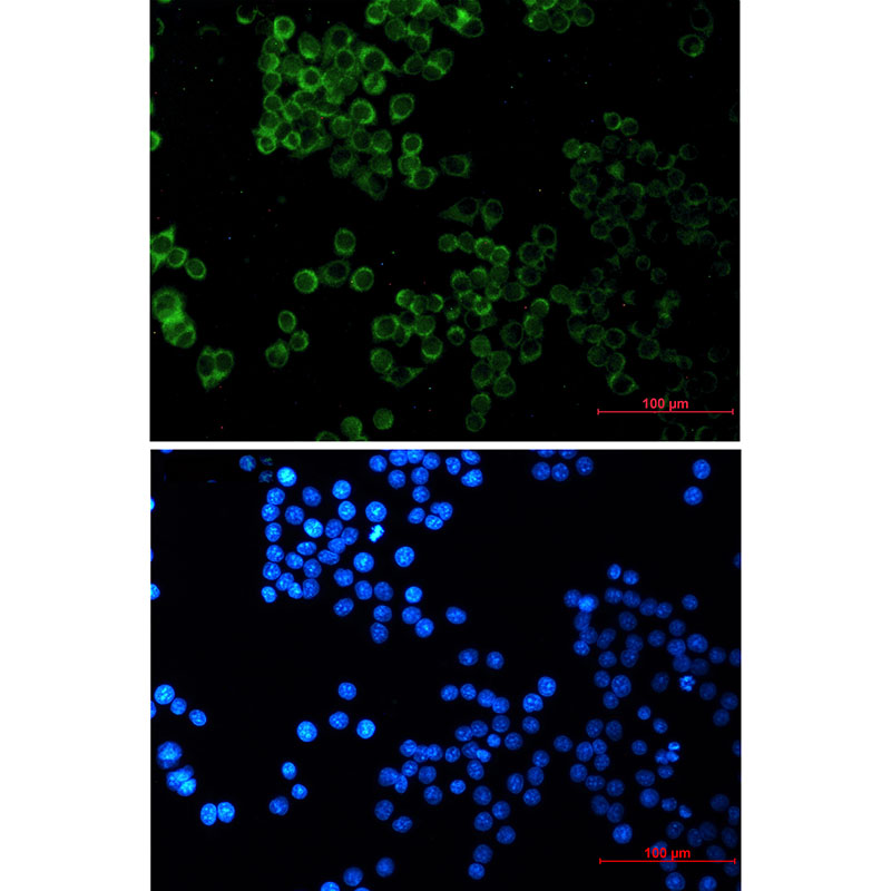 Rabbit Monoclonal Antibody to SESN2