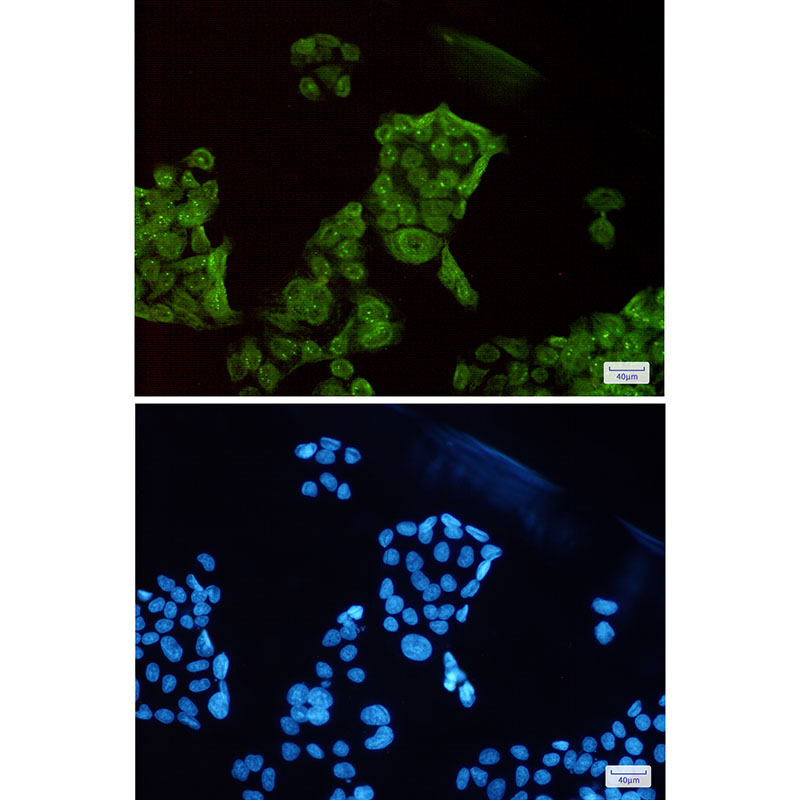 Rabbit Monoclonal Antibody to SET