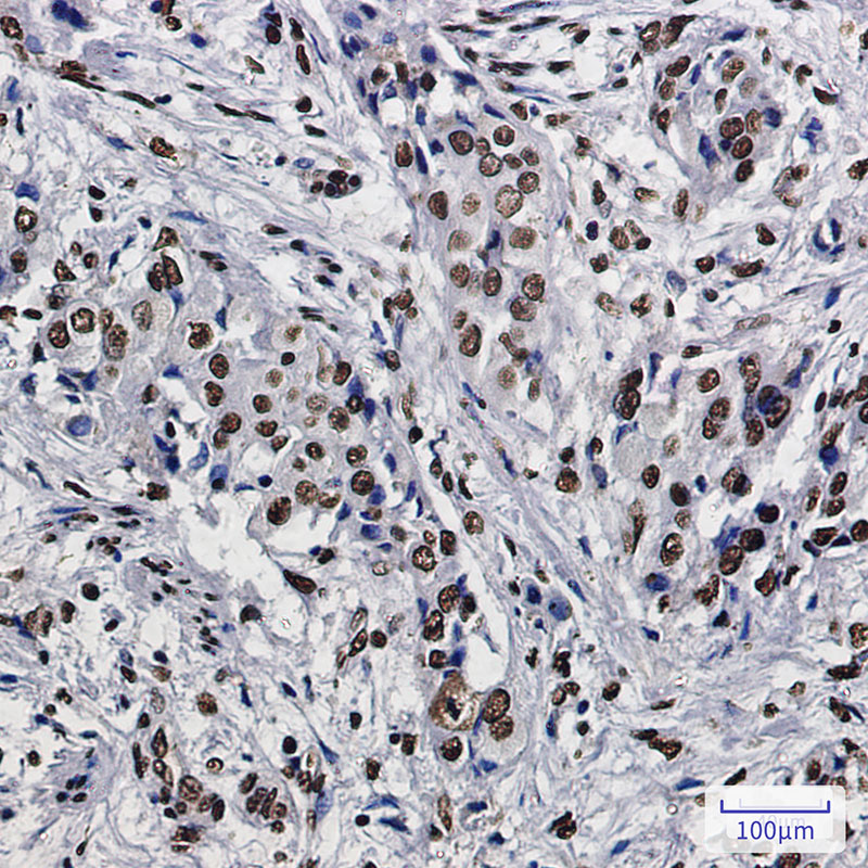 Rabbit Monoclonal Antibody to SET