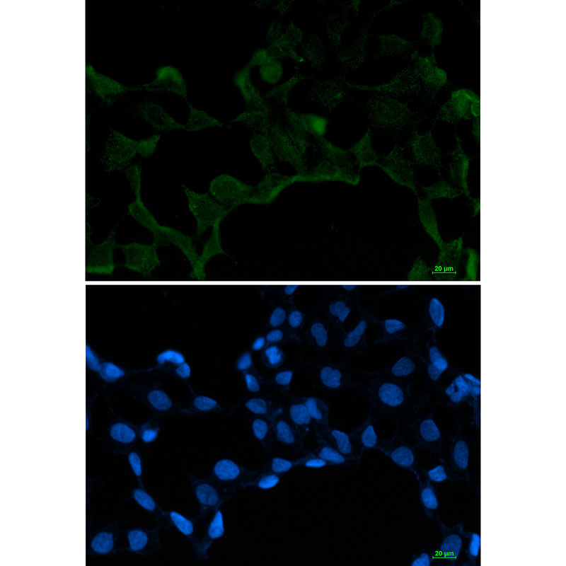 Rabbit Monoclonal Antibody to SF2