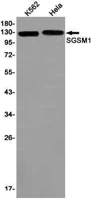SGSM1