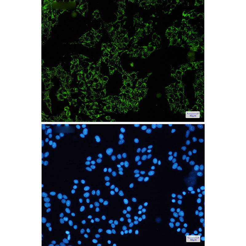 Rabbit Monoclonal Antibody to SGSM1