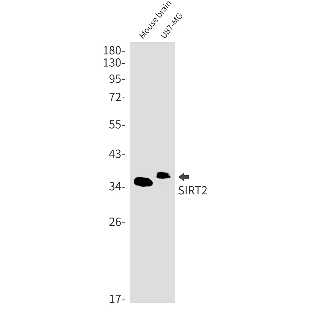 SIRT2