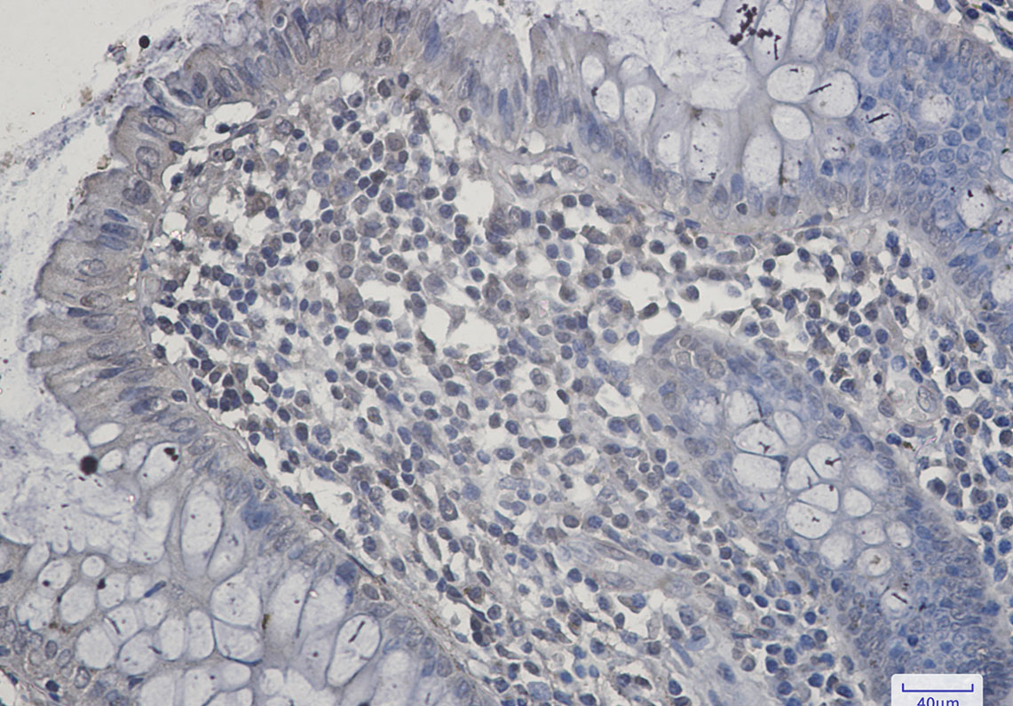 Rabbit Monoclonal Antibody to SIRT2